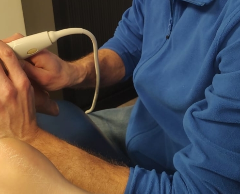 De therapeut voert de behandelmethode shockwave therapie bij hielspoor uit